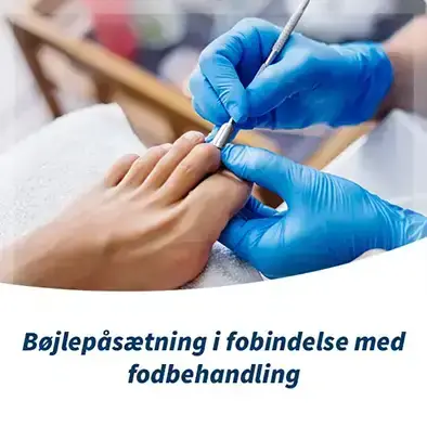 Bøjlebehandling