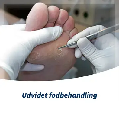 Almindelig Fodbehandling